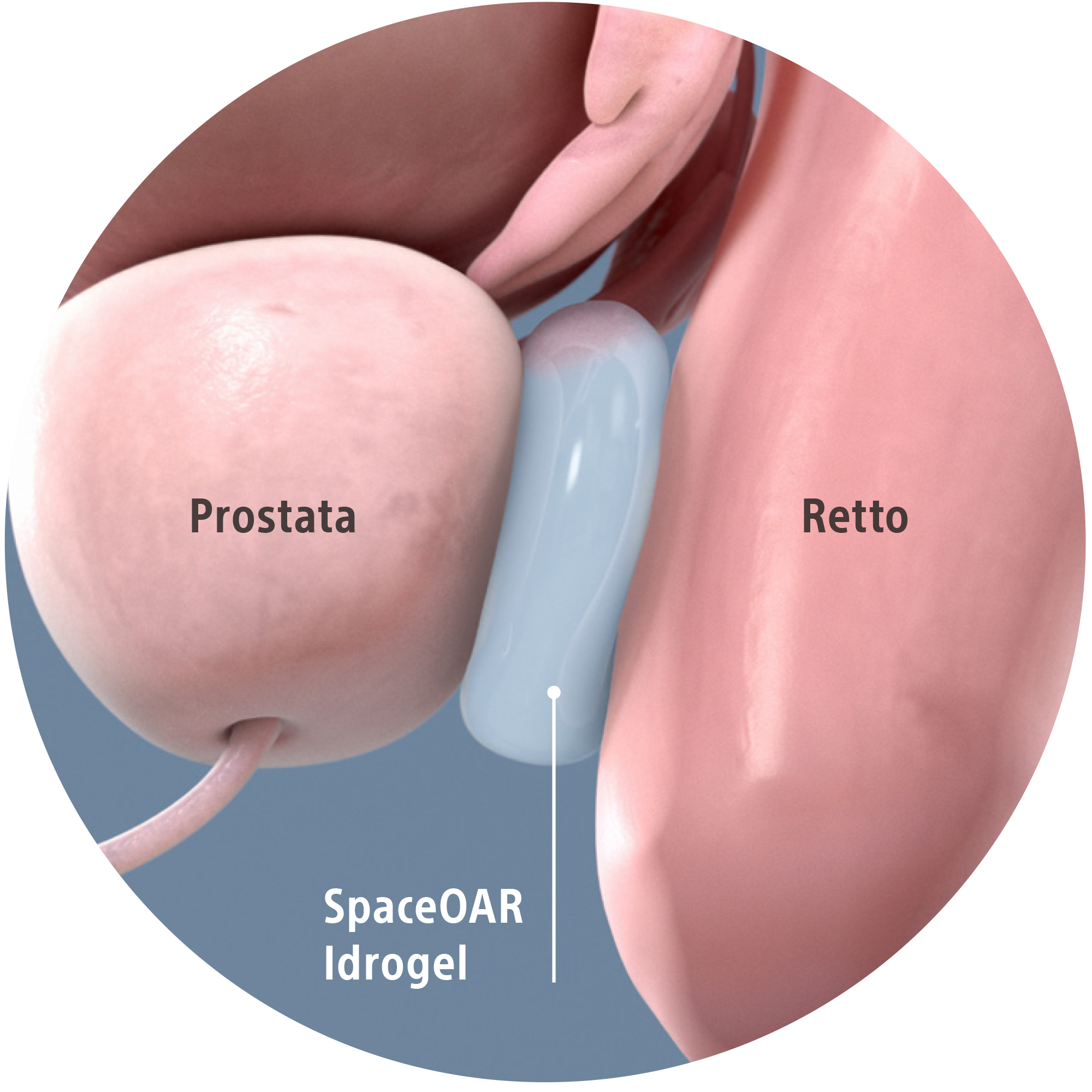 iniezioni prostata